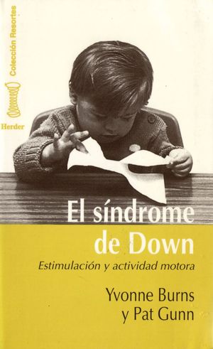 EL SINDROME DE DOWN