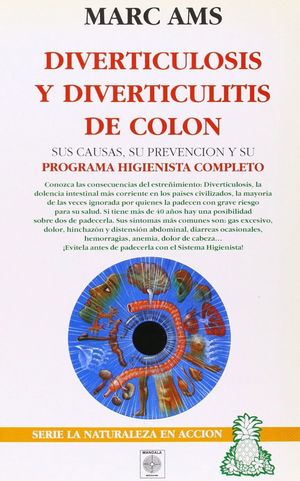 DIVERTICULOSIS Y DIVERTICULITIS DE COLON