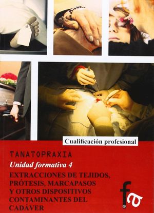 EXTRACCIONES DE TEJIDOS, PROTESIS, MARCAPASOS Y OTROS DISPOSITIVO