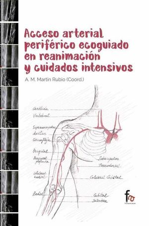 ACCESO ARTERIAL PERIFERICO ECOGUIADO EN REANIMACION Y CUIDADOS