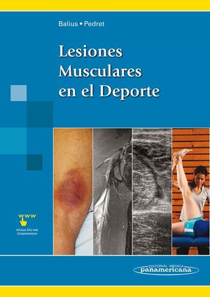 LESIONES MUSCULARES EN EL DEP.+E